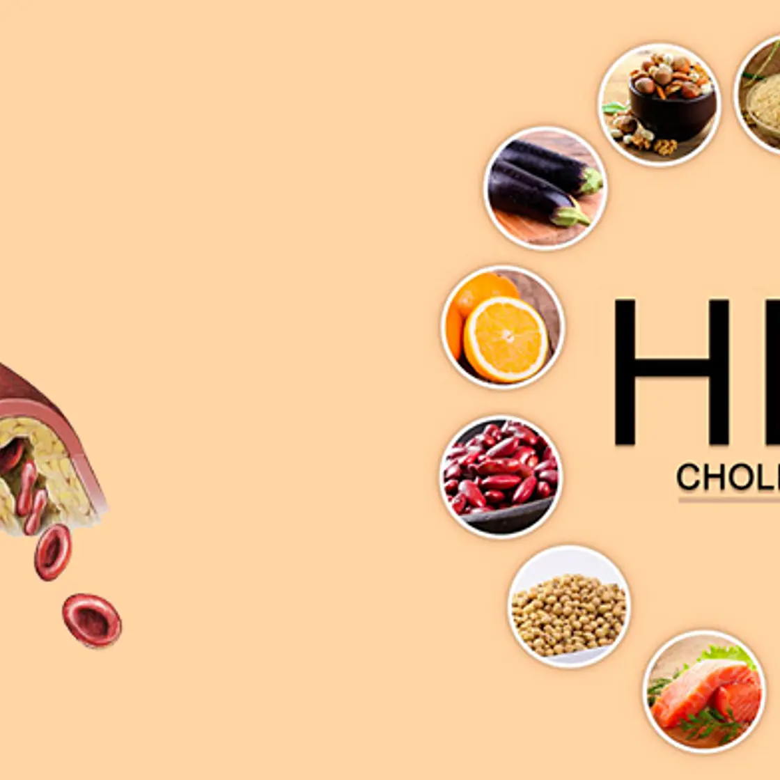 What Is HDL Cholesterol? What Can It Help With? HDL ኮሌስትሮል ምንድን ነው? ምን ሊረዳ ይችላል?