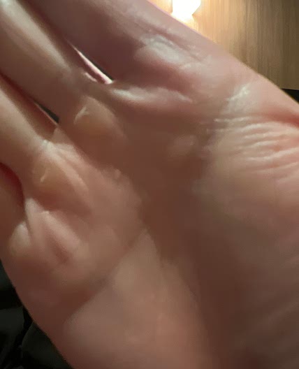 Potato Breakfast Skillet | Student Breakfast Series