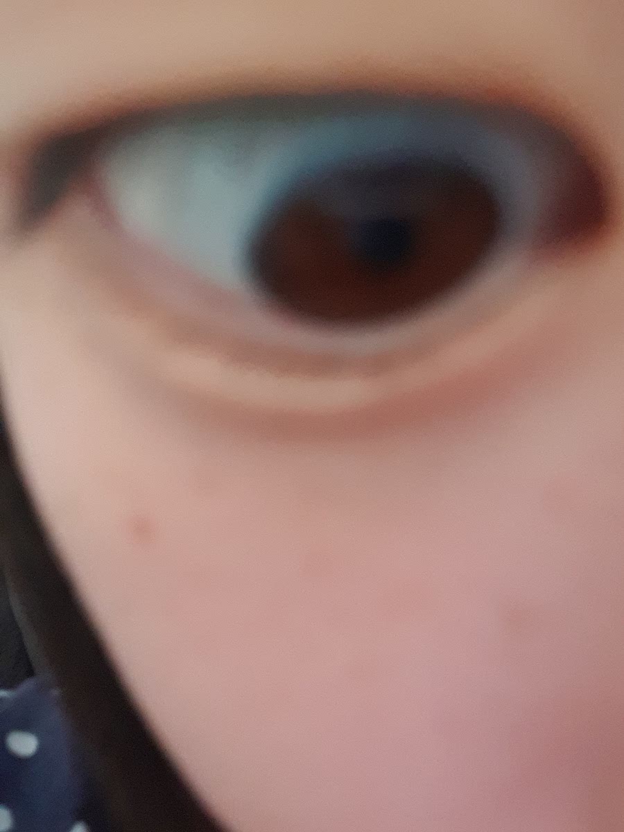 Yes