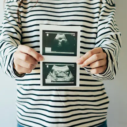 PCOS Pregnancy Protocol