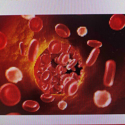 U of U Thrombosis